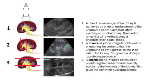 IMAGE 1 Kidney Imaging Planes