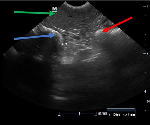 IMAGE 5 Left lobe pancreas dog