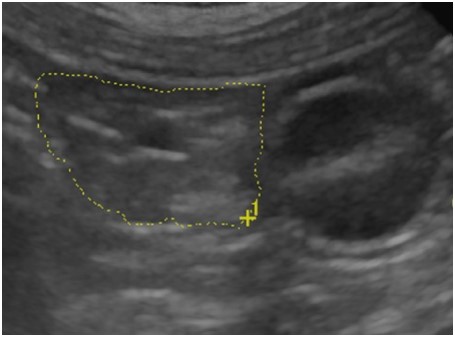 IMAGE 7 Right lobe pancreas dog transverse