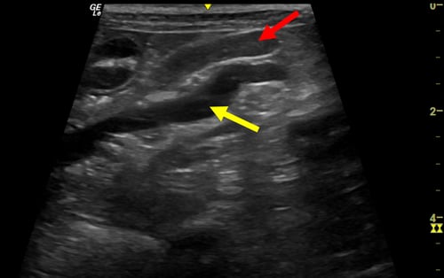 Image 2 (1)