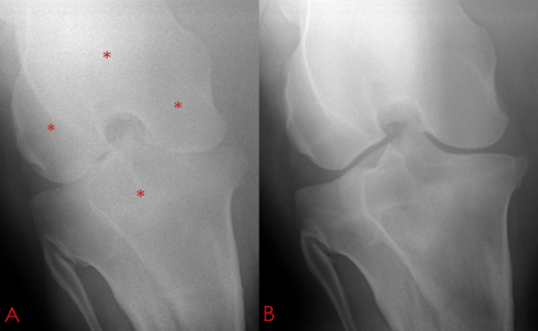 radiographic image of a stifle