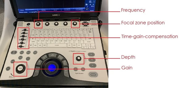 Ultrasound machine