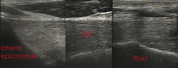 composite image