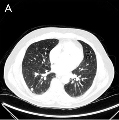 Image courtesy of Trafton Drew and Jeremay Wolfe/Brigham and Women's hospital
