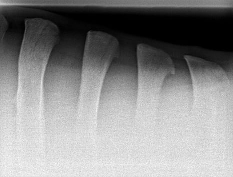 radiography of the equine spine