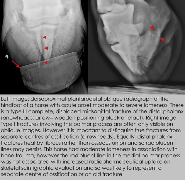 Dorsoproximal