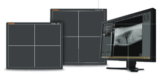 carestream-focus-2-1