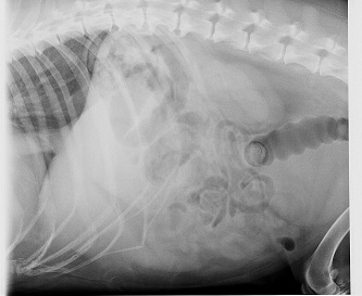 Abdominal x-ray - reduced image quality due to exposure