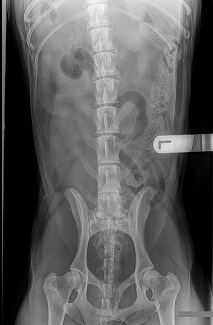 Abdominal x-ray - good positioning