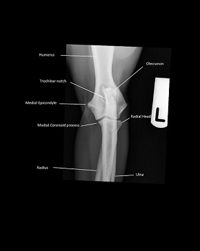 Craniocaudal Elbow