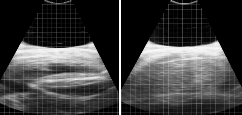 Duo-Scan:Go Oceanic