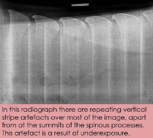 Radiograph