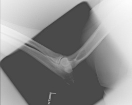 High kv image