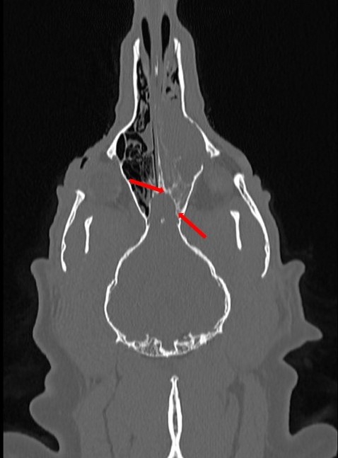 bone reconstruction image