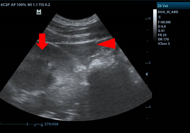 kidney and liver