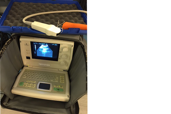Ultrasound scanner