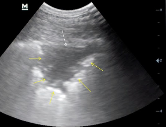 Ultrasound sheep