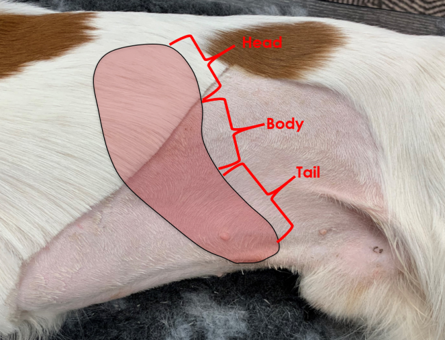 Spleen position