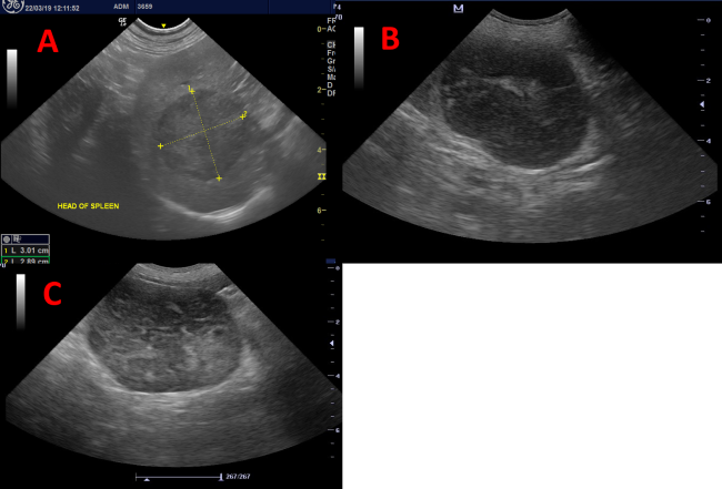 Splenic neoplasia